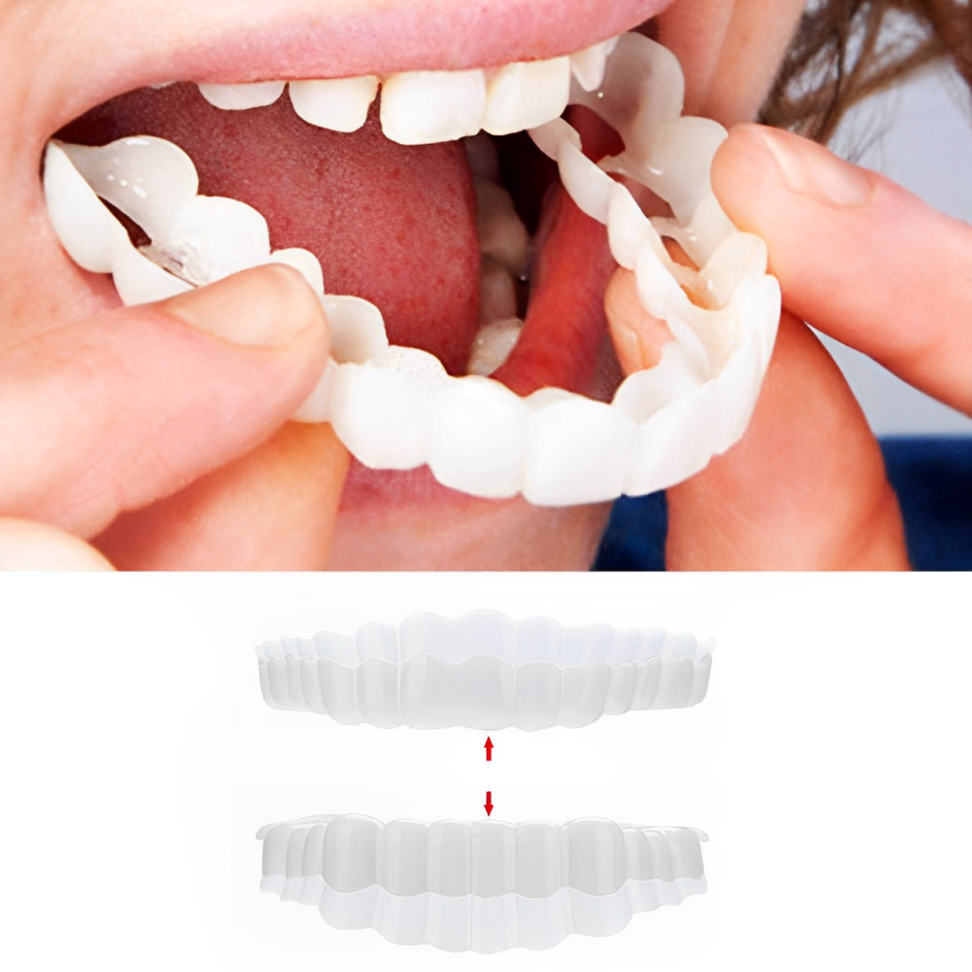 Smile Veneer - Belvarden