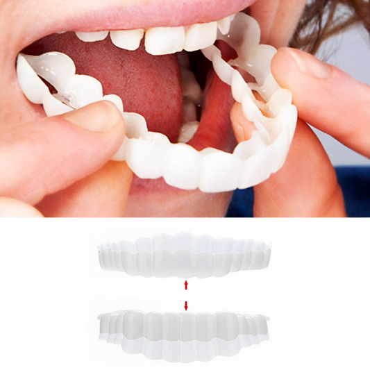 Smile Veneer - Belvarden